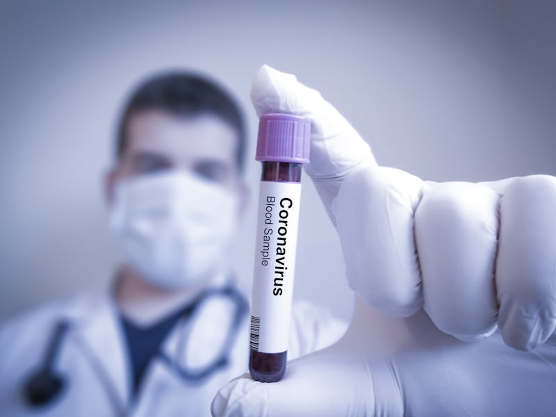 Coronavirus 2019-nCoV Blood Sample. Corona virus outbreaking. Epidemic virus Respiratory Syndrome. C...