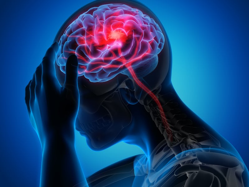 Man with a headache - Stroke -3D Illustration