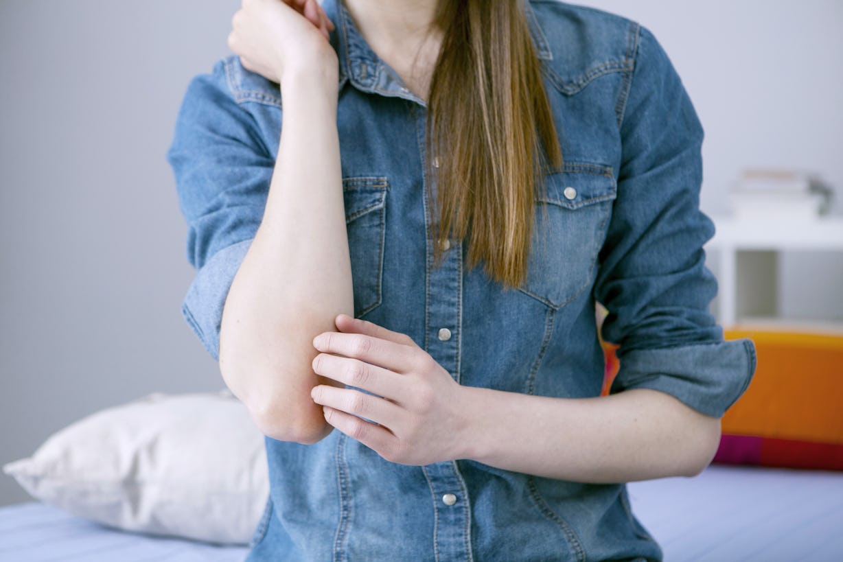 5 Ways To Handle Psoriasis Outbreaks