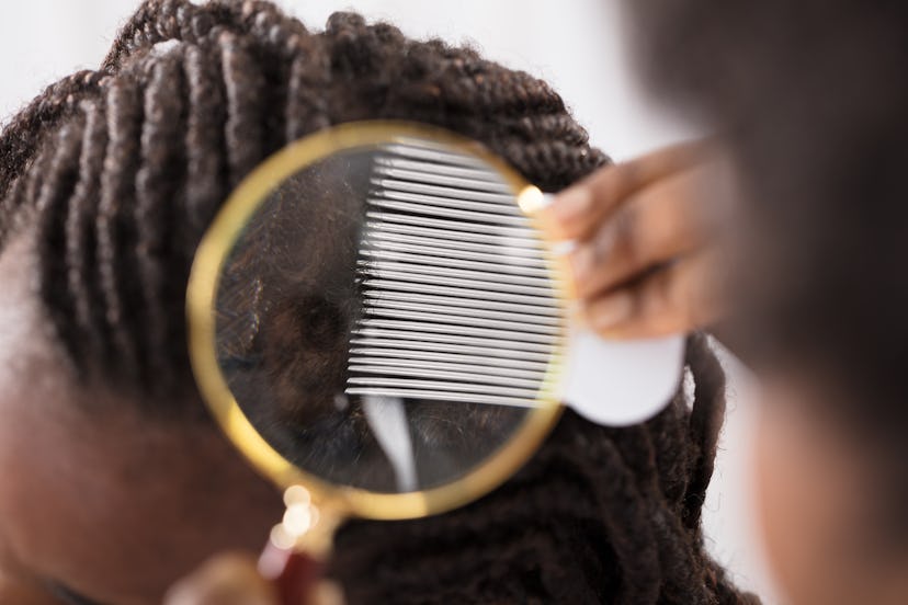 Close-up Of Dermatologist Looking At Patient's Hair Through Magnifying Glass