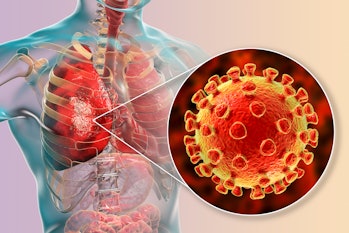 Pneumonia caused by a novel Chinese Wuhan coronavirus Covid-19, 2019-nCoV, conceptual 3D illustratio...