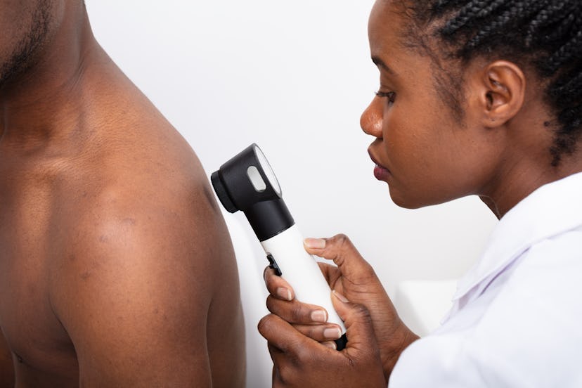 Close-up Of A Female Doctor Checking Pigment Skin On Man's Back With Dermatoscope