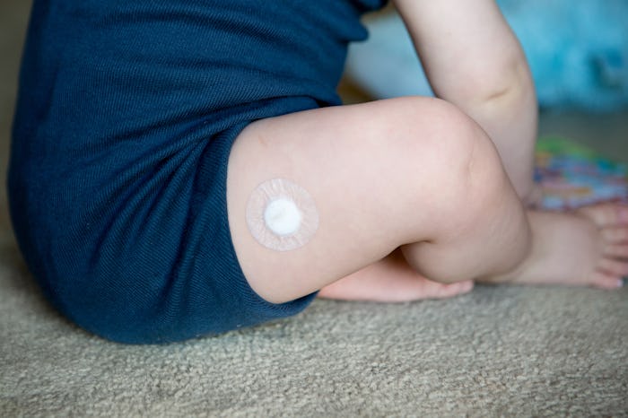 Baby with bandaid after vaccination or needle or a sore leg.