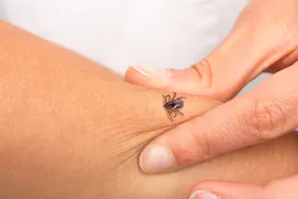 Tick that is biting an arm to a girl