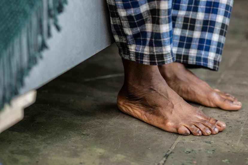 Loss of hair on toes could indicate poor circuation.