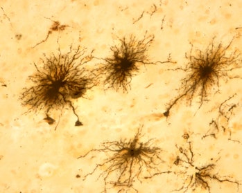 astrocytes technical image 