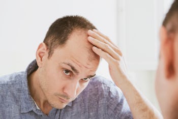 Male pattern hair loss problem concept. Young caucasian man looking at mirror worried about balding....