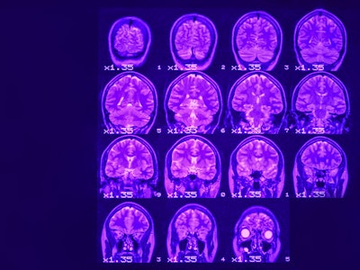 MRI of the brain on a black background with purple  backlight. Left  place for advertising inscripti...