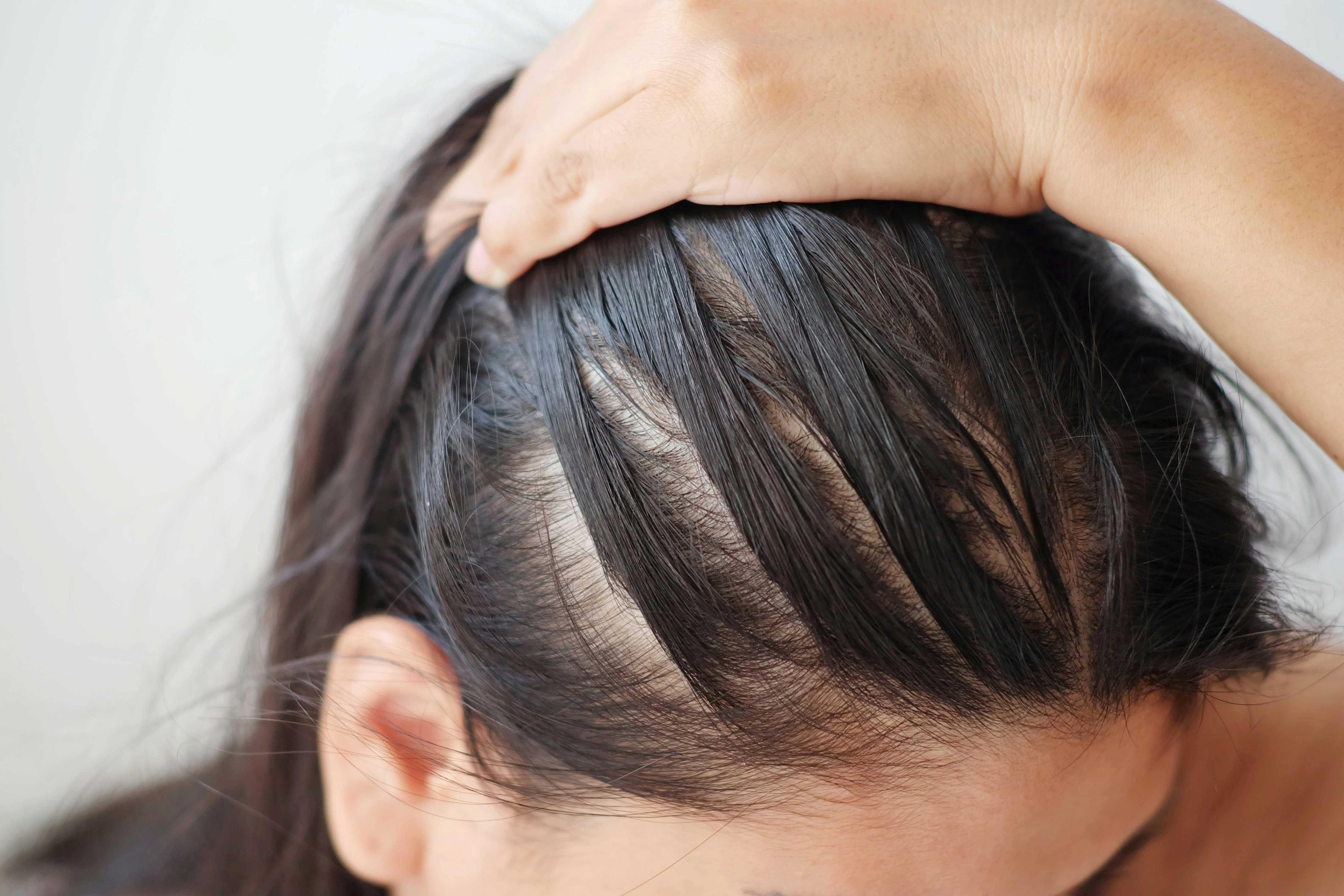 How To Tell If Your Hair Is Thinning & 7 Things That Can Help