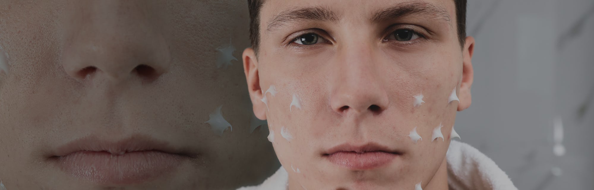 Teenage guy with problem skin applying cream in bathroom. Acnephobia