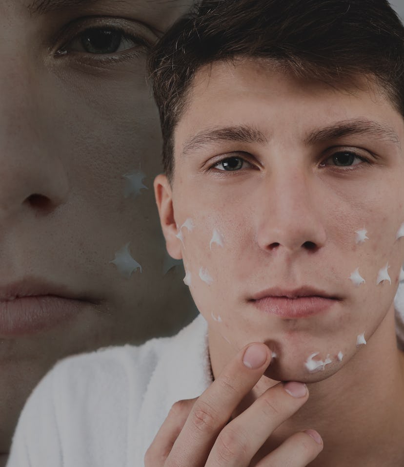 Teenage guy with problem skin applying cream in bathroom. Acnephobia 