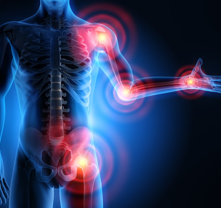 Painful Joints - 3D Illustration