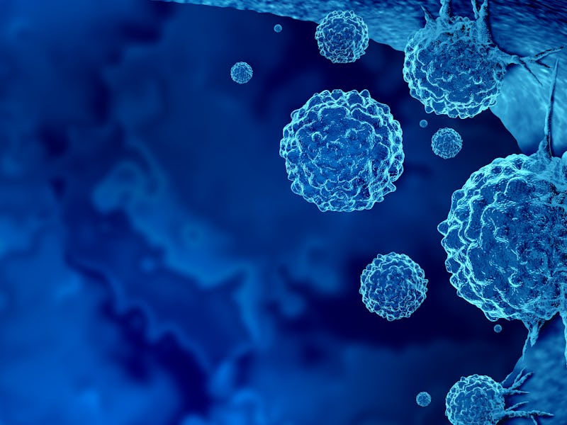 Cancer outbreak and treatment for malignant cancer cells in a human body caused by carcinogens and g...