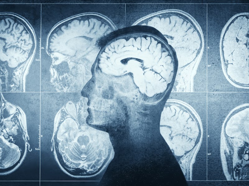 Human head on CT scan with brain background. Overlay on old paper texture. Retro style. Medical, sci...