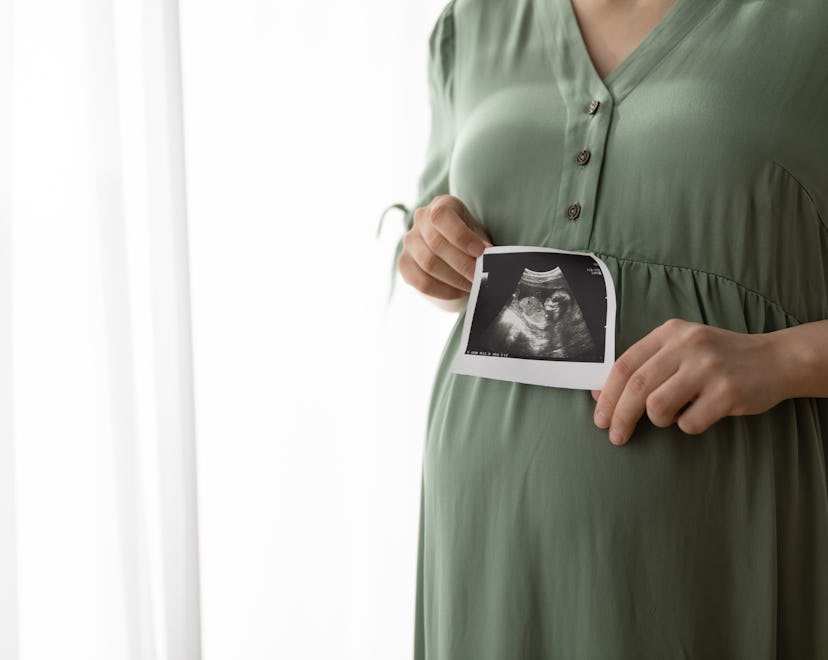 Cropped shot of pregnant woman showing sonogram image at camera, caption this photo with a pregnancy...