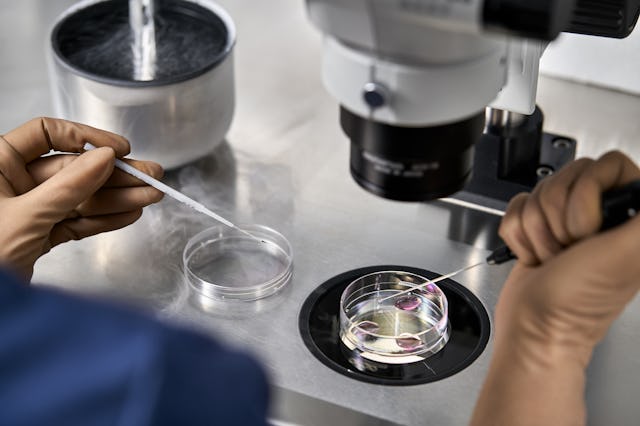 IVF sex selection, although currently legal in the U.S., remains a controversial practice.