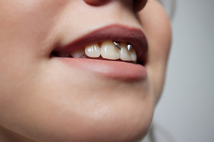A smile piercing on the upper gum of the mouth.