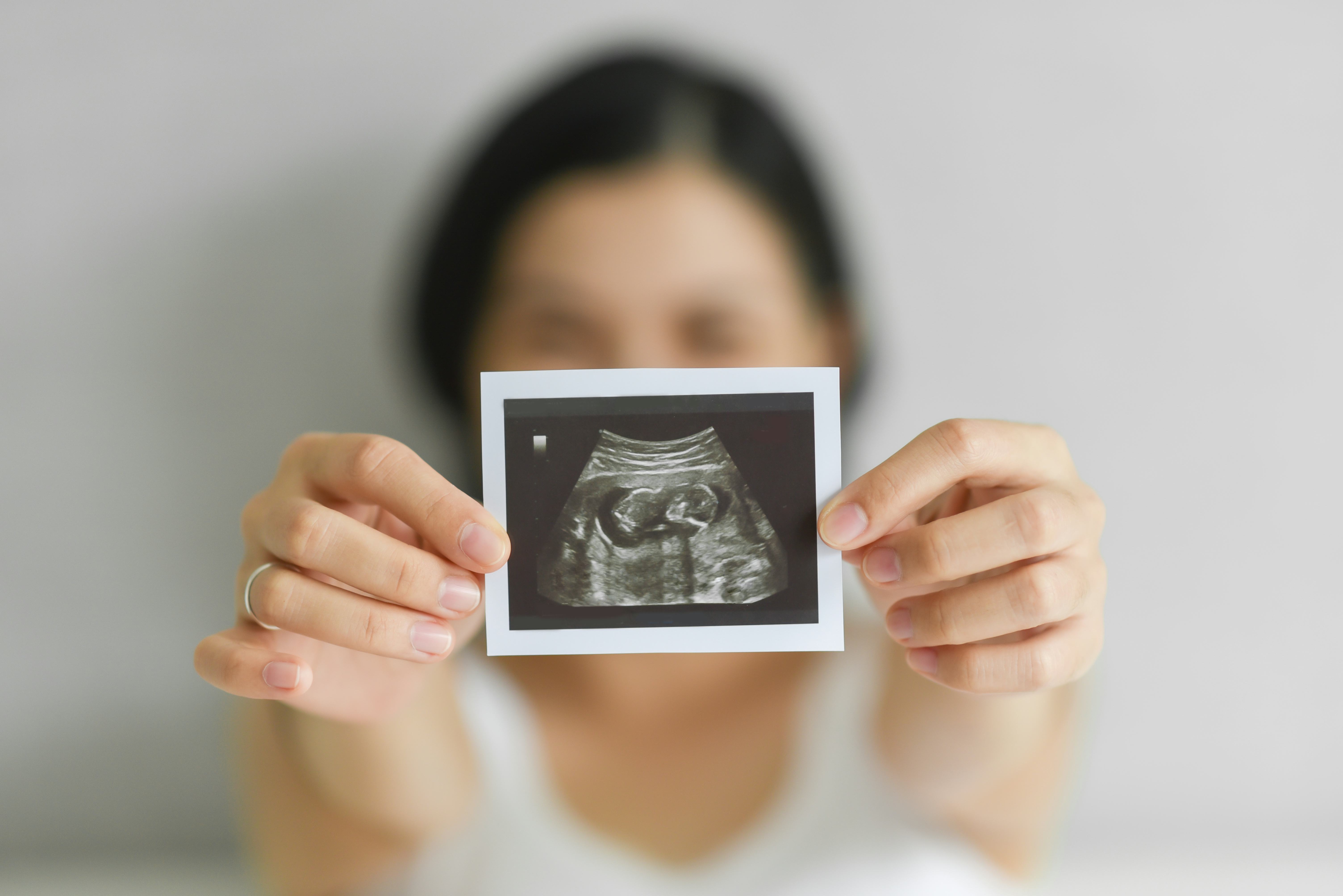 Can Sex Positions Determine A Baby's Gender? Experts Explain