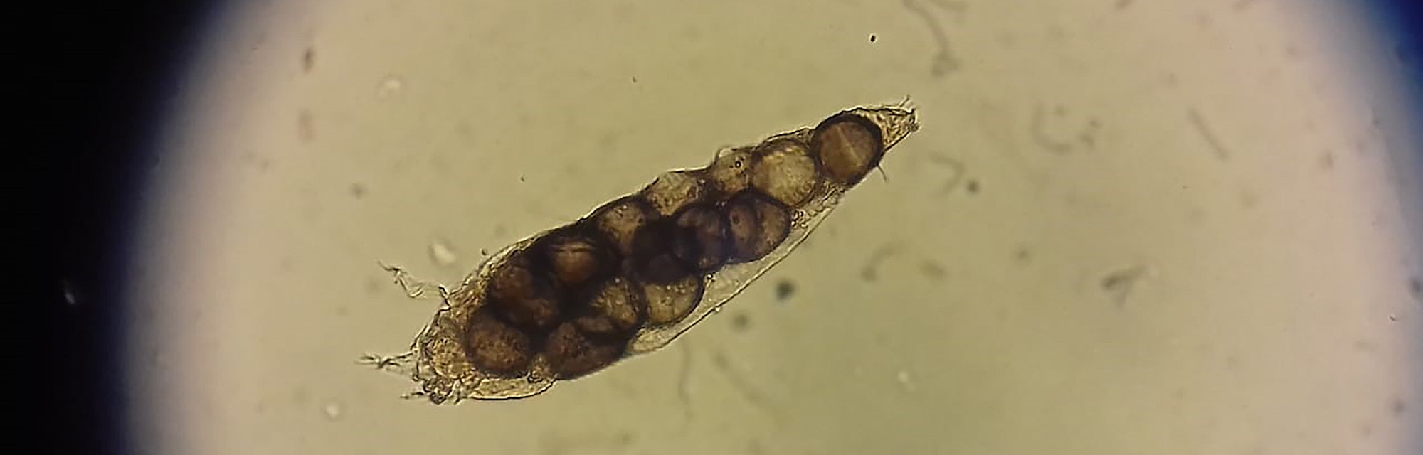Demodex parasite under skin in dog or people take photo from microscope
