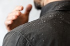 A bearded man in a black shirt shakes dandruff of his shoulder.