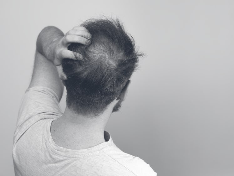 Behind view of a balding man