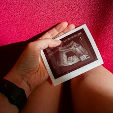 A woman's hand holds an ultrasound picture of an early pregnancy. A new study found that the risk of...