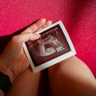 A woman's hand holds an ultrasound picture of an early pregnancy. A new study found that the risk of...