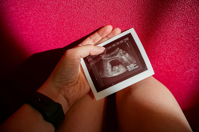 A woman's hand holds an ultrasound picture of an early pregnancy. A new study found that the risk of...