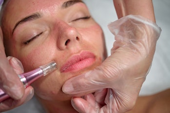 Cosmetician makes microneedling, care to the patient using dermapen