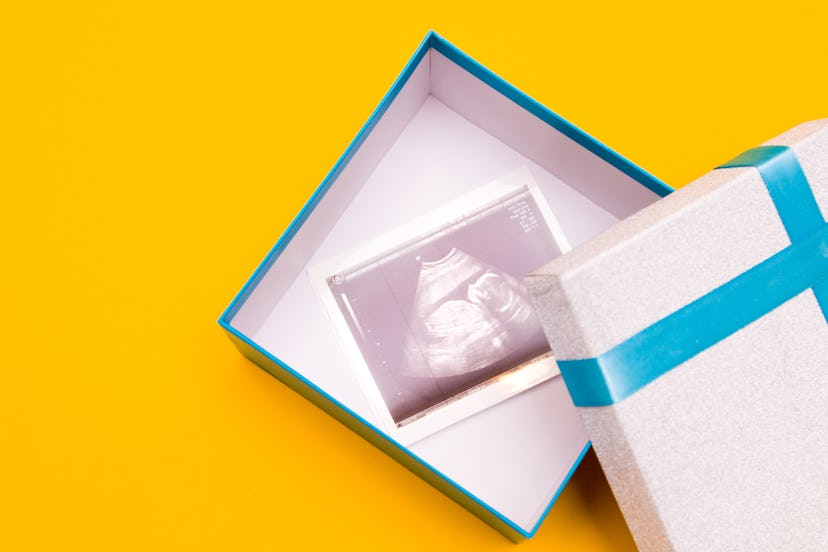 ultrasound picture in a silver box with a blue ribbon: valentines day pregnancy announcement idea