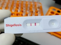 Rapid test cassette for Shigella infection (shigellosis)