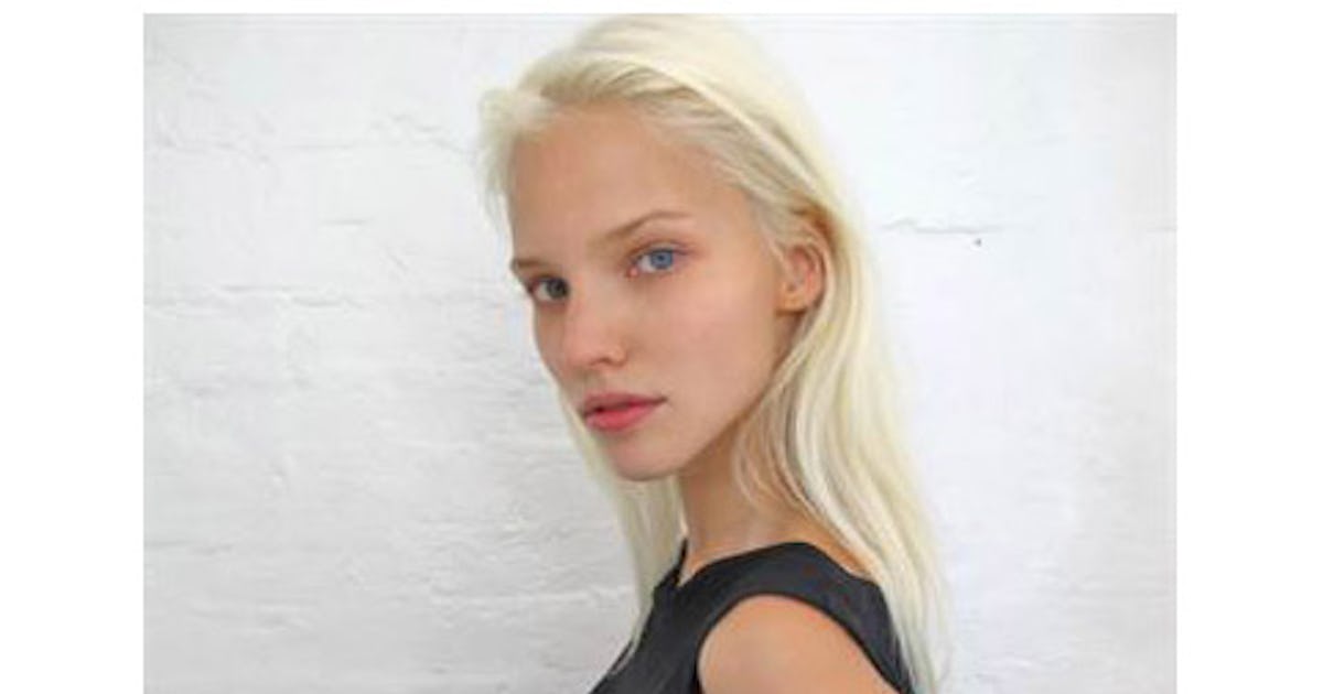 Саша лусс до и после похудения Happy-laser.ru