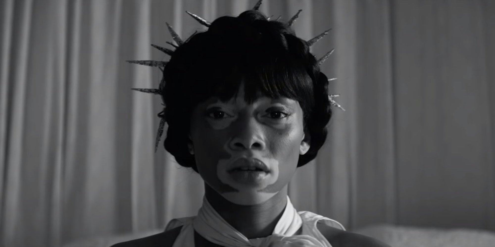 How Winnie Harlow Went from America’s Next Top Model to Beyoncé’s