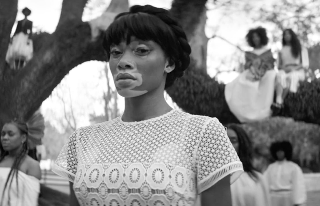 How Winnie Harlow Went from America’s Next Top Model to Beyoncé’s