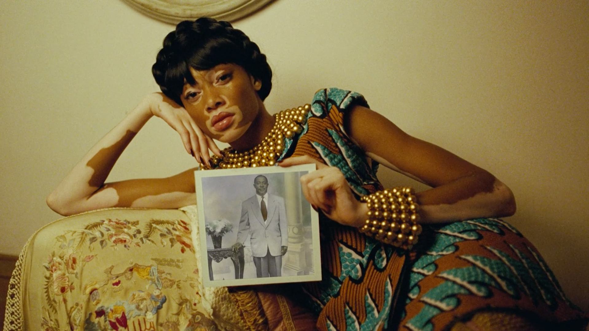 How Winnie Harlow Went from America’s Next Top Model to Beyoncé’s