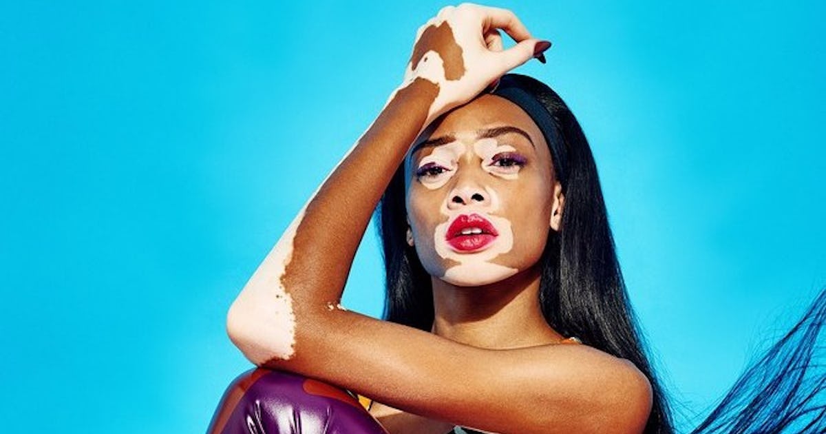 Winnie Harlow Claps Back At The Assumption That She S Wearing Makeup When She S Not Winnie Harlow Claps Back At The Assumption That She S Wearing Makeup When She S Not