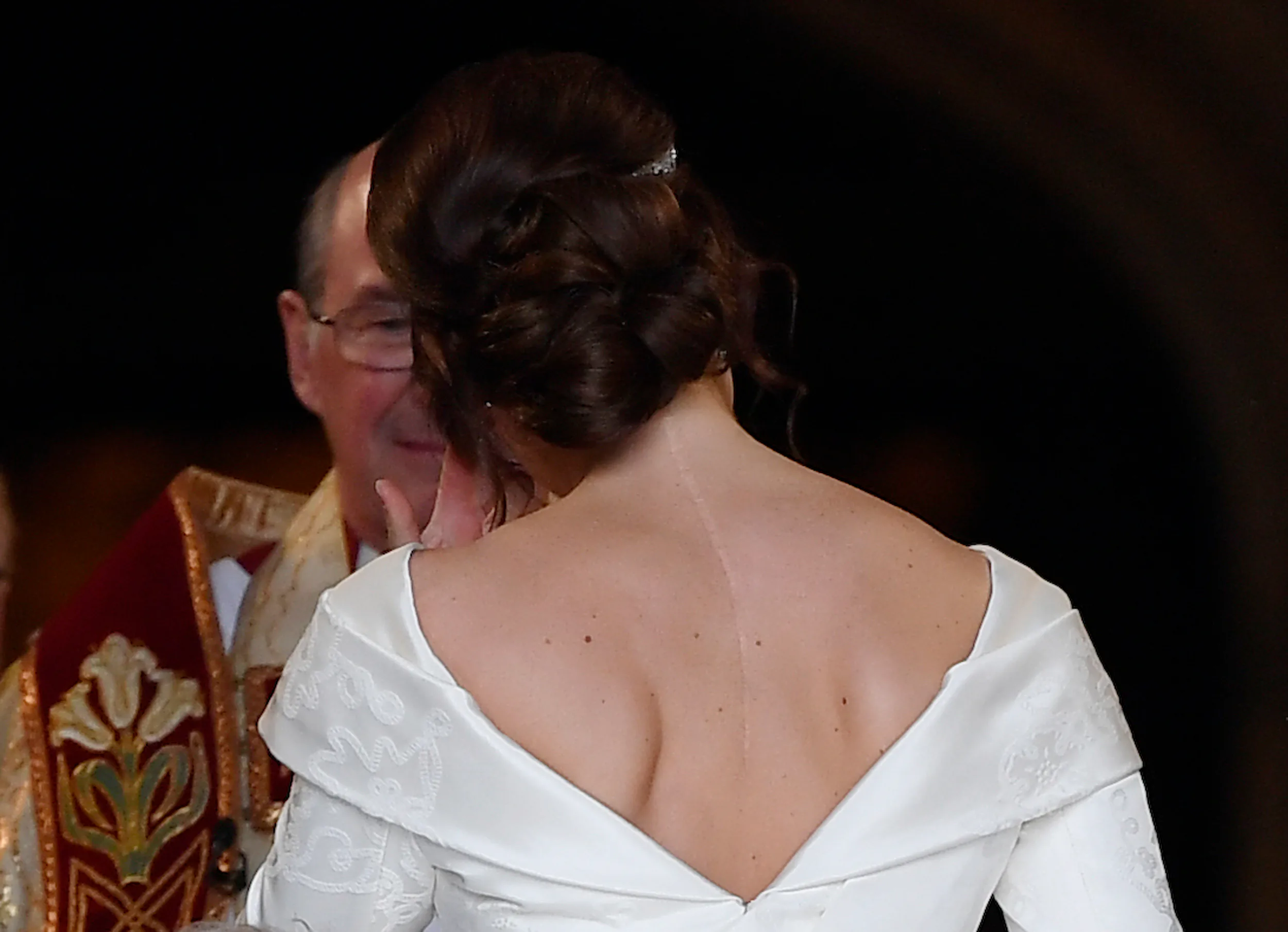 Princess Eugenie's Wedding Dress Showed Off Scars from Scoliosis Surgery,  On Purpose