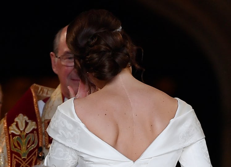 Princess Eugenie scar embed