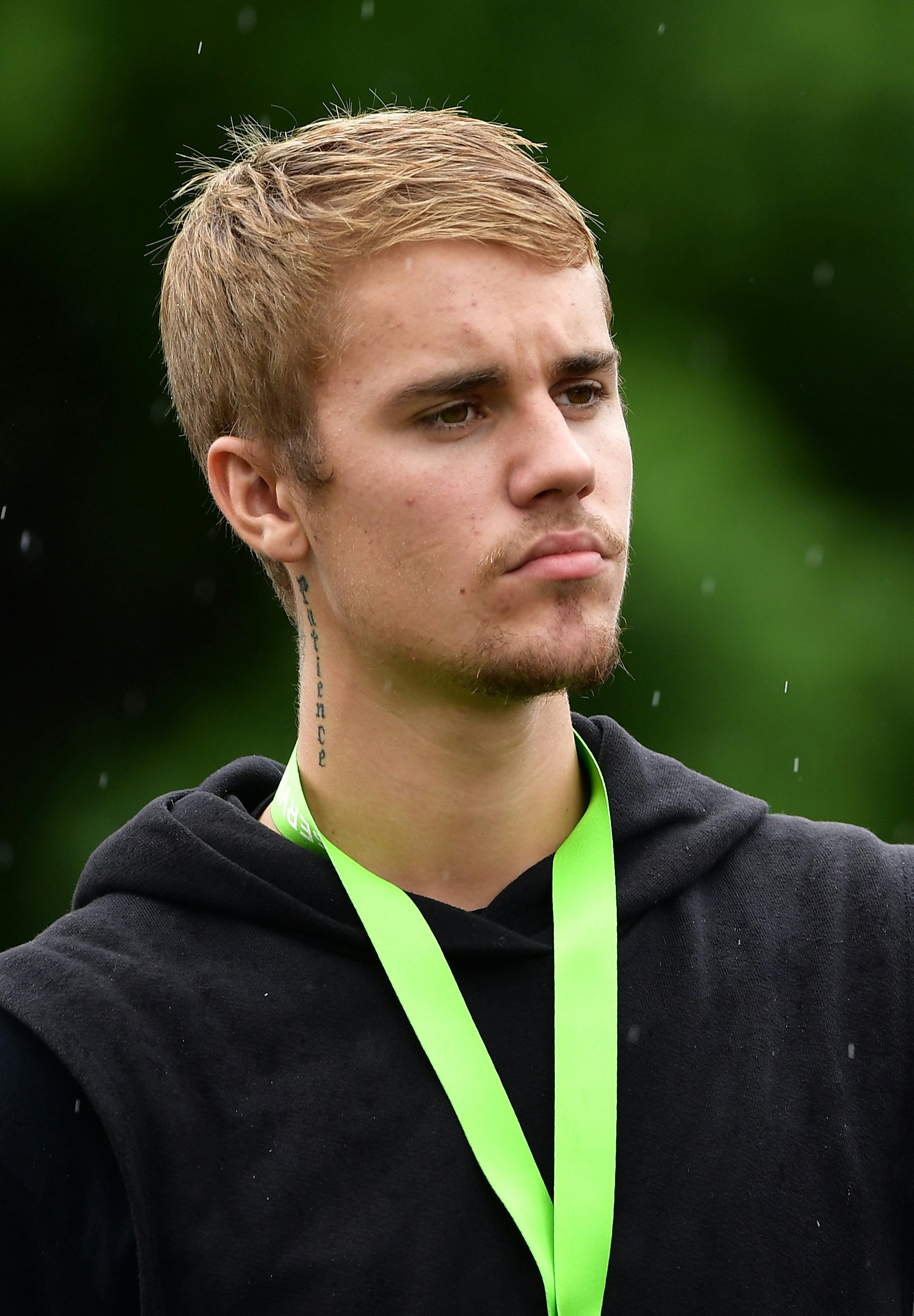Justin Bieber Hair Loss: Everything You Need To Know - Wimpole Clinic