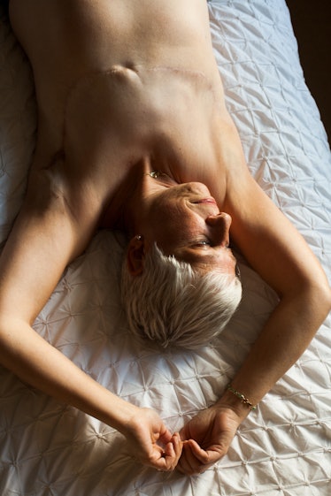 A mature woman with mastectomy scars lying on the bed