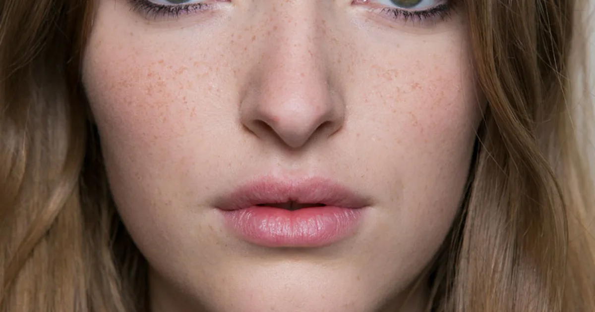Zit Emergency? How To Get Rid Of It Overnight