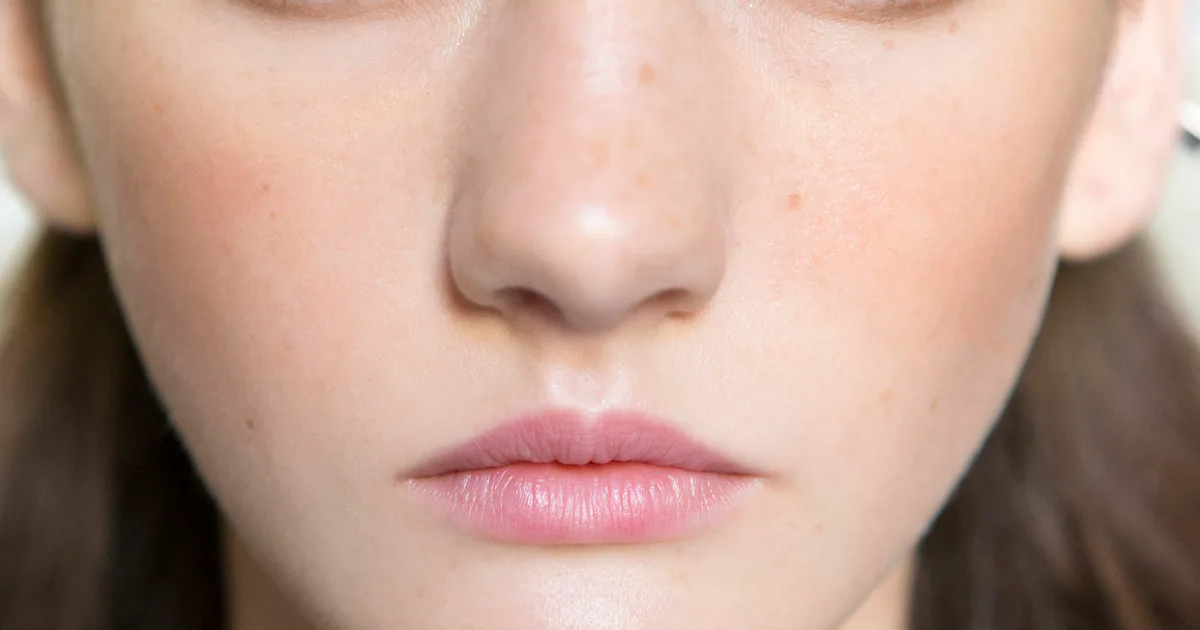 5 Common Botox Mistakes To Avoid